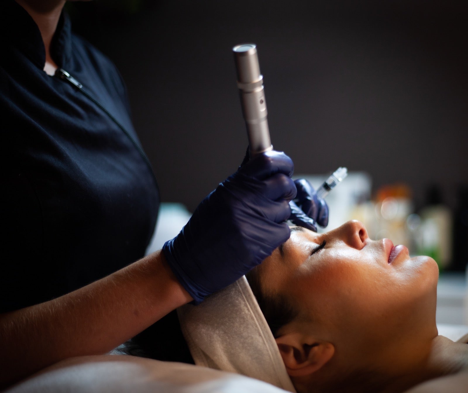 Microneedling